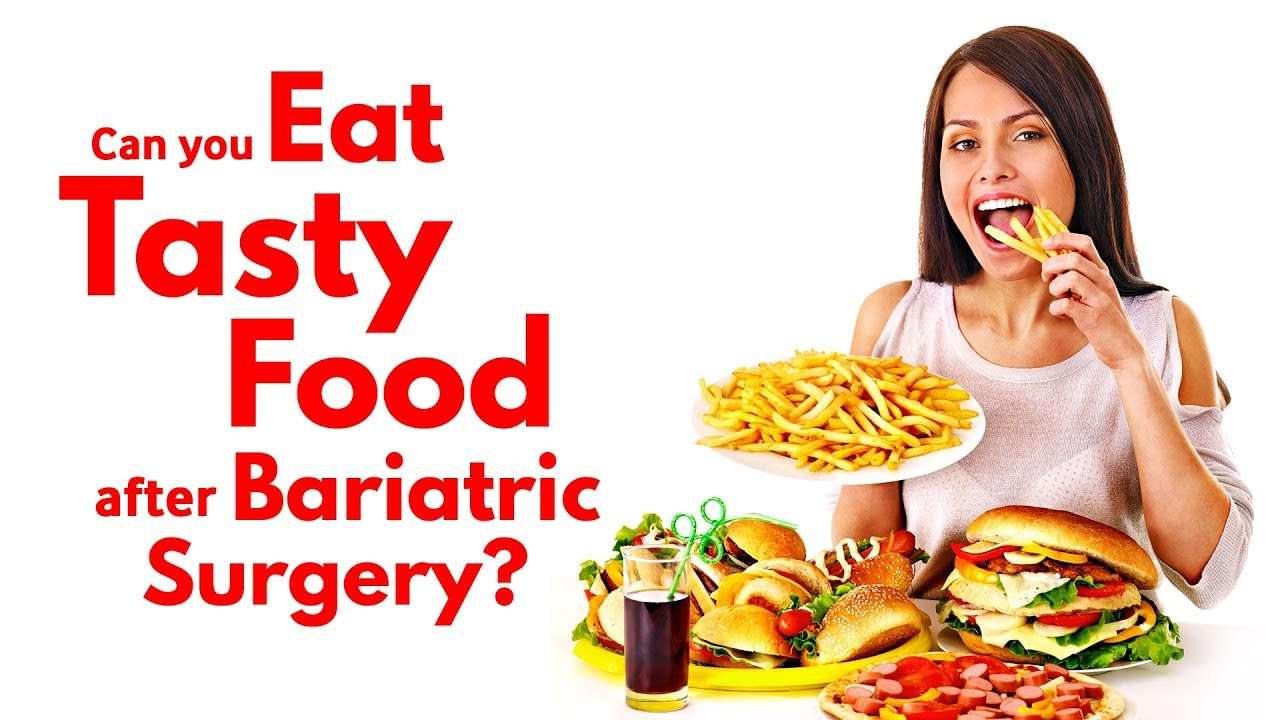 Can you eat tasty food after bariatric surgery?